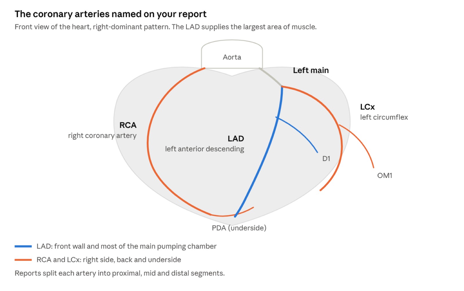 Your CT Coronary Angiogram Report, Decoded (illustrative image)